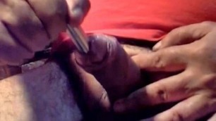 Sounding Completely inserting a 15 16 mm dilator 4